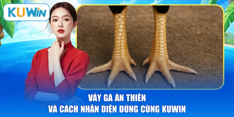 Vảy Gà Án Thiên Và Cách Nhận Diện Đúng Cùng KUWIN